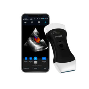ECÓGRAFO PORTÁTIL BESTSCAN MX3